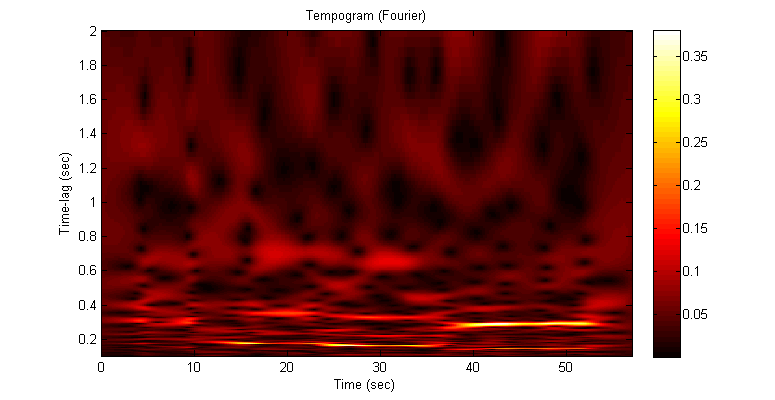 test_TempogramToolbox